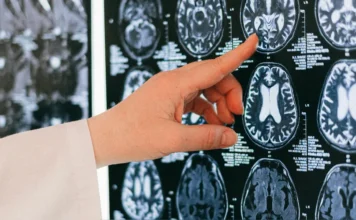 Científicos Identifican una Nueva Enfermedad Neurológica Ultrarrara con Solo 13 Casos en el Mundo